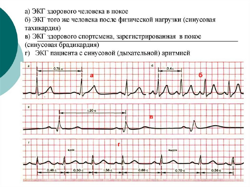 Ақмола облысында марафондарға қатысу ережелері қатаңдатылды