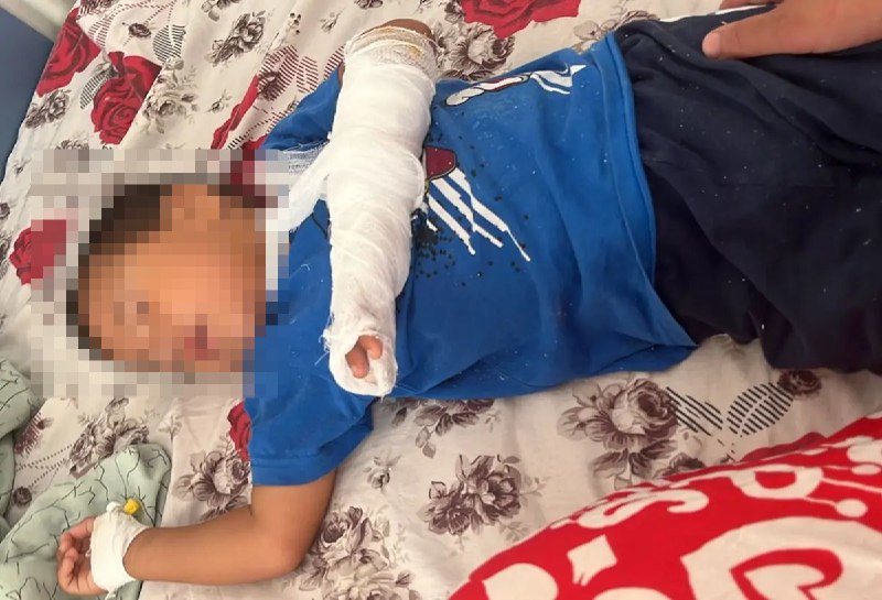 Маңғыстаудағы жекеменшік балабақшада үш жасар бала жарақат алды: ата-анасына «200 мың теңгеге ұмытуды» ұсынған